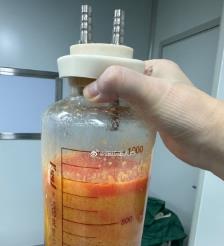 昌都水动力吸脂手术要做多久？